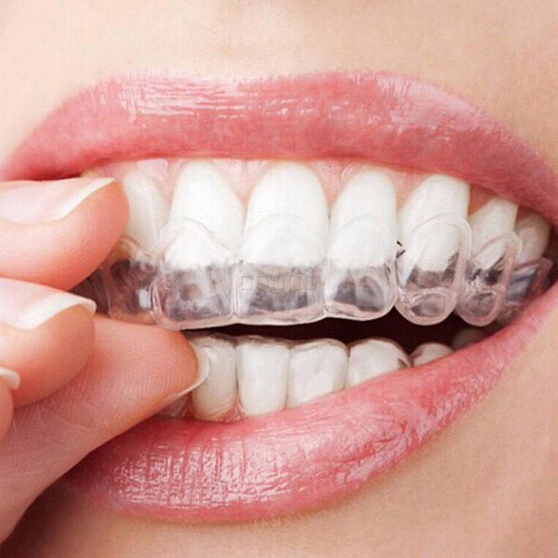 Teeth Whitening With Trays - 투명 열 성형 치아 미백 트레이,