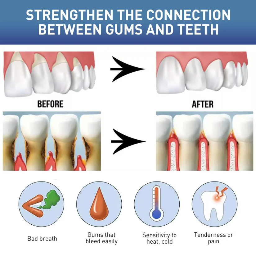 60ML 천연 구강 관리액 치아 불편함 완화 건강한 잇 - Teeth Whitening Natural 리뷰 및 가격