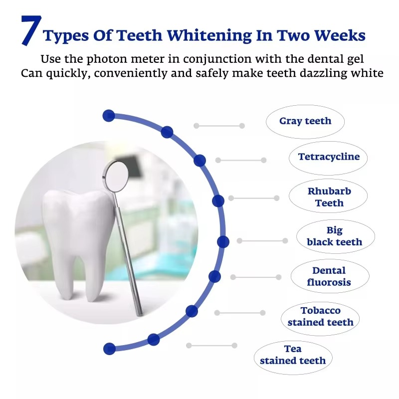 지능형 LED 블루 라이트 휴대용 USB/iPhone/ - Teeth Whitening With Trays 리뷰 및 가격