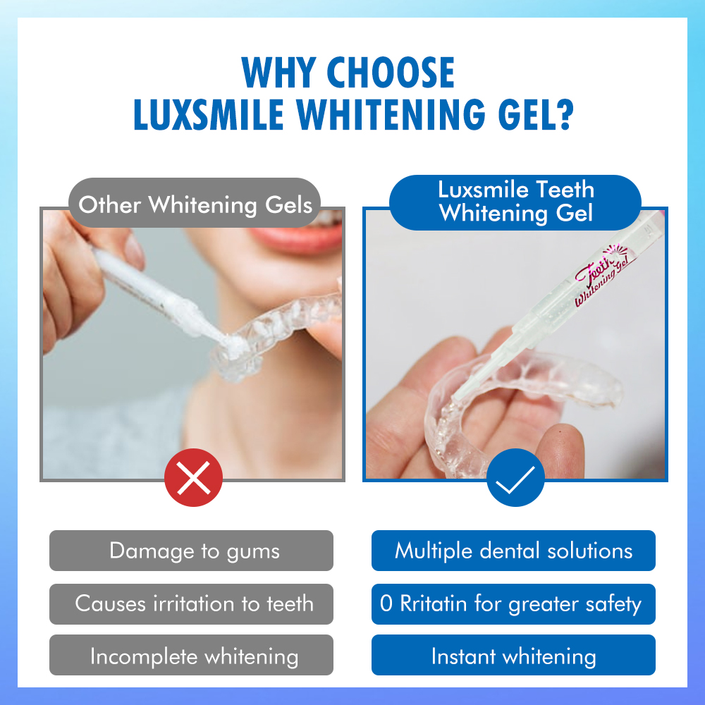 치아 미백 젤 PAP 또는 35%CP 치아 미백 젤 구 - Teeth Whitening With Trays 리뷰 및 가격