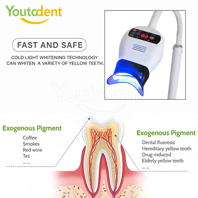전문 치과용 3색 광 램프 치아 미백기 미백 촉진 장치 - Whitening Teeth Dentist 리뷰 및 가격