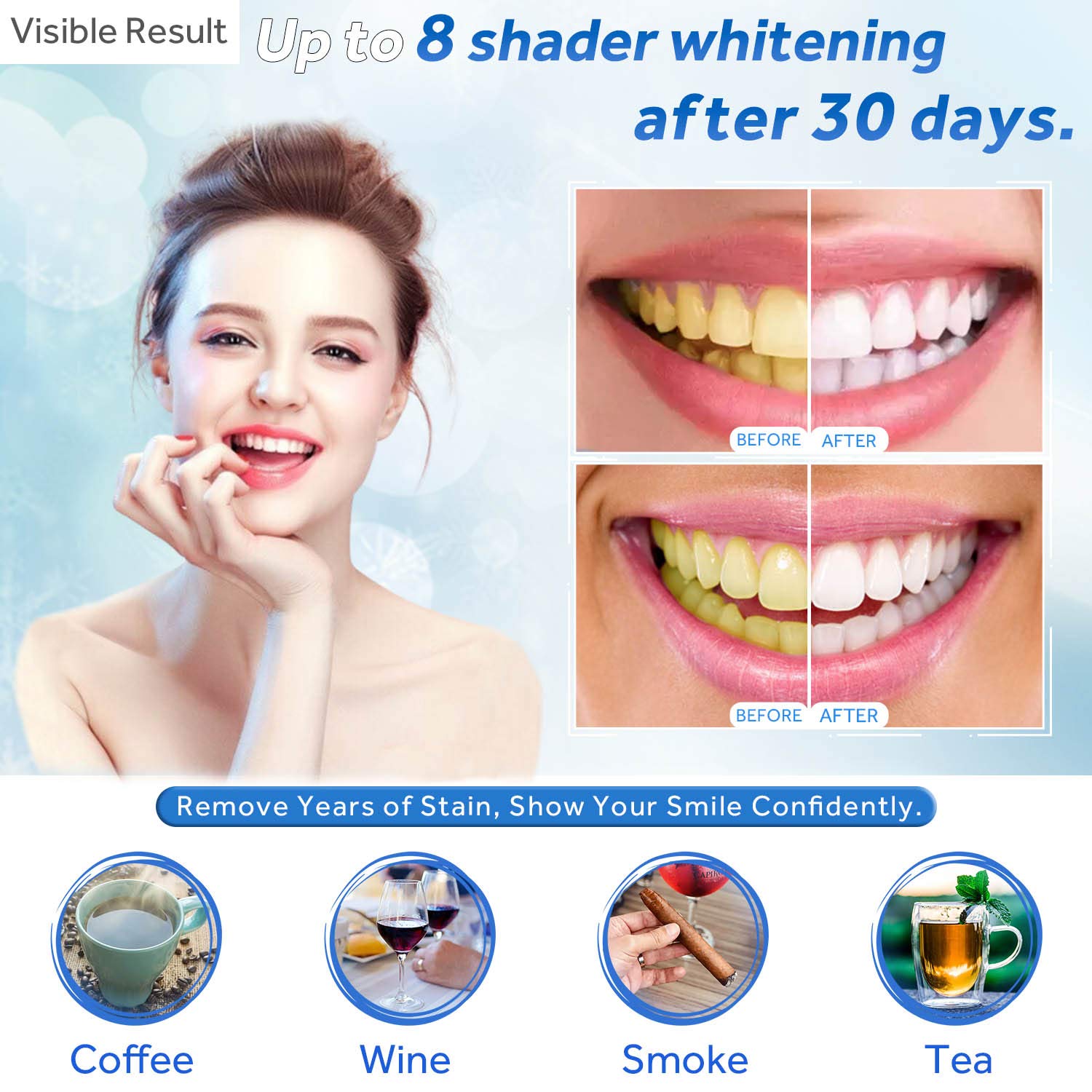 치아 미백 젤 리필 주사기 치아 미백 젤 인비스알라인  - Teeth Whitening Gel Syringes 리뷰 및 가격