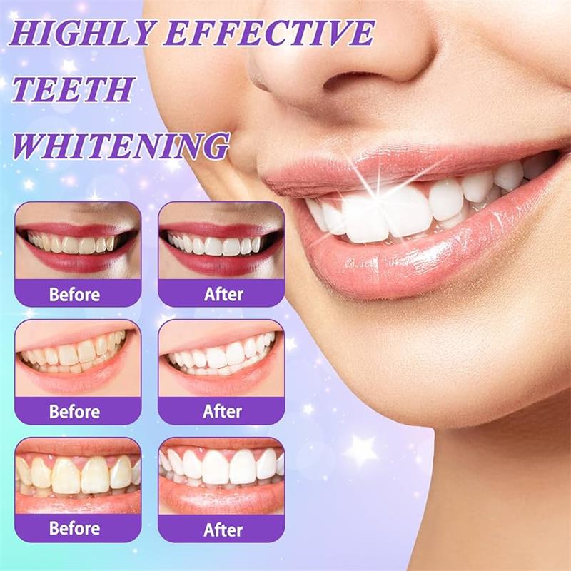 9D 퍼플 치아 미백 치약 무스, 누런 치아 및 플라그 - Teeth Whitening Natural 리뷰 및 가격