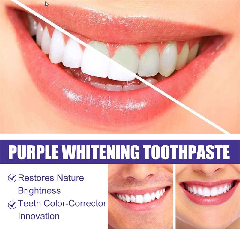 9D 퍼플 치아 미백 치약 무스, 누런 치아 및 플라그 - Teeth Whitening Natural 리뷰 및 가격