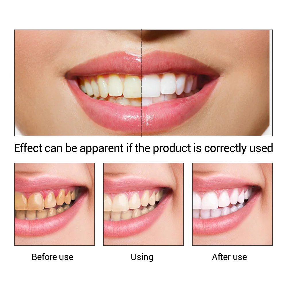 FTEENPLY 치아 미백 에센스 파우더 구강 위생 청 - Teeth Whitening Natural 리뷰 및 가격