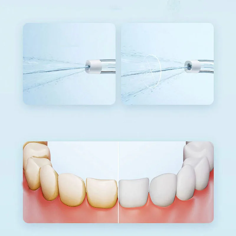 샤오미 휴대용 구강 세척기 F300 치과용 워터젯 워터 - Teeth Whitening Quick 리뷰 및 가격